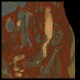 Diverticulitis of sigmoid colon, fistula, abscess, VRT: CT - Computed tomography